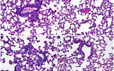 Evaluation of antiviral therapies in respiratory and neurological disease models of Enterovirus D68 infection in mice
